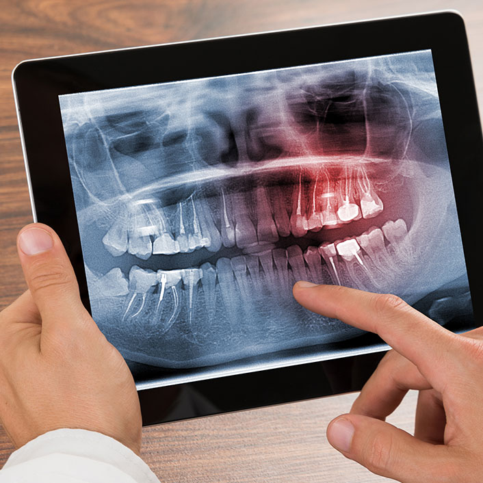 Digital X-Ray - Dental Technology
