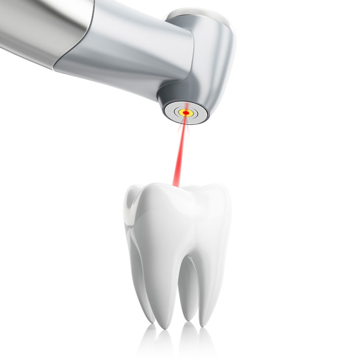 Soft Tissue Laser - Dental Technology